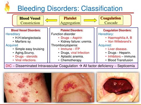 Coagulation Disorders Hereditary And Hemorrhagic Disorders Coagulation Disorders Hereditary And Hemorrhagic Disorders