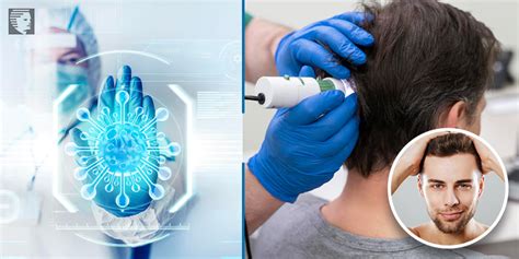 Latest Hair Replacement Technology Today Latest Hair Replacement Technology Today